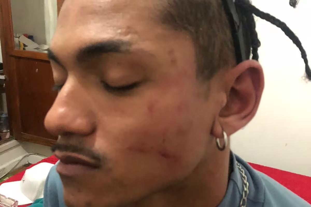 Rapaz denuncia racismo e agressões em show do Alok em MG: 'Me senti um nada'